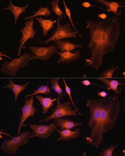 TUBB3 / Tubulin Beta 3 Antibody