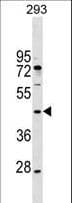 Polyclonal Rabbit anti-Human MAEA / EMP Antibody (aa16-42, WB)