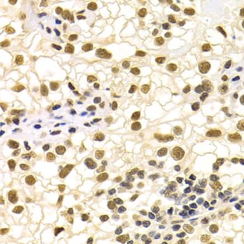 Polyclonal Rabbit anti-Human DDB1 Antibody (IHC, WB)