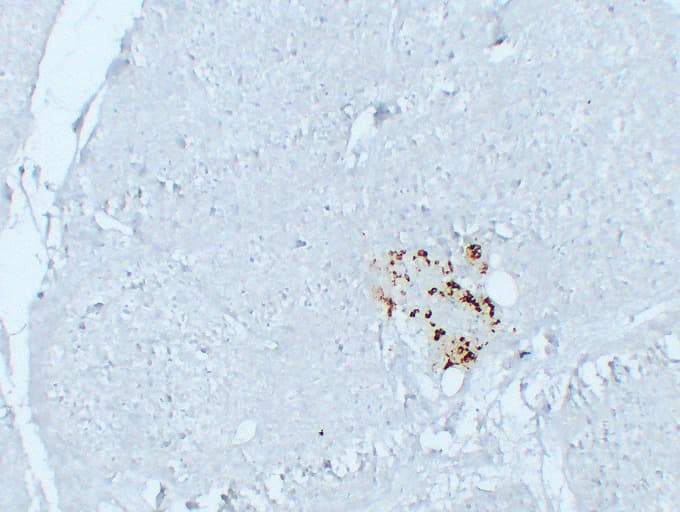 GCG / Glucagon Antibody (clone ABT-GCG)