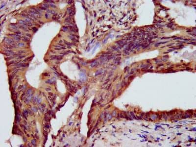 HIST1H3A Antibody