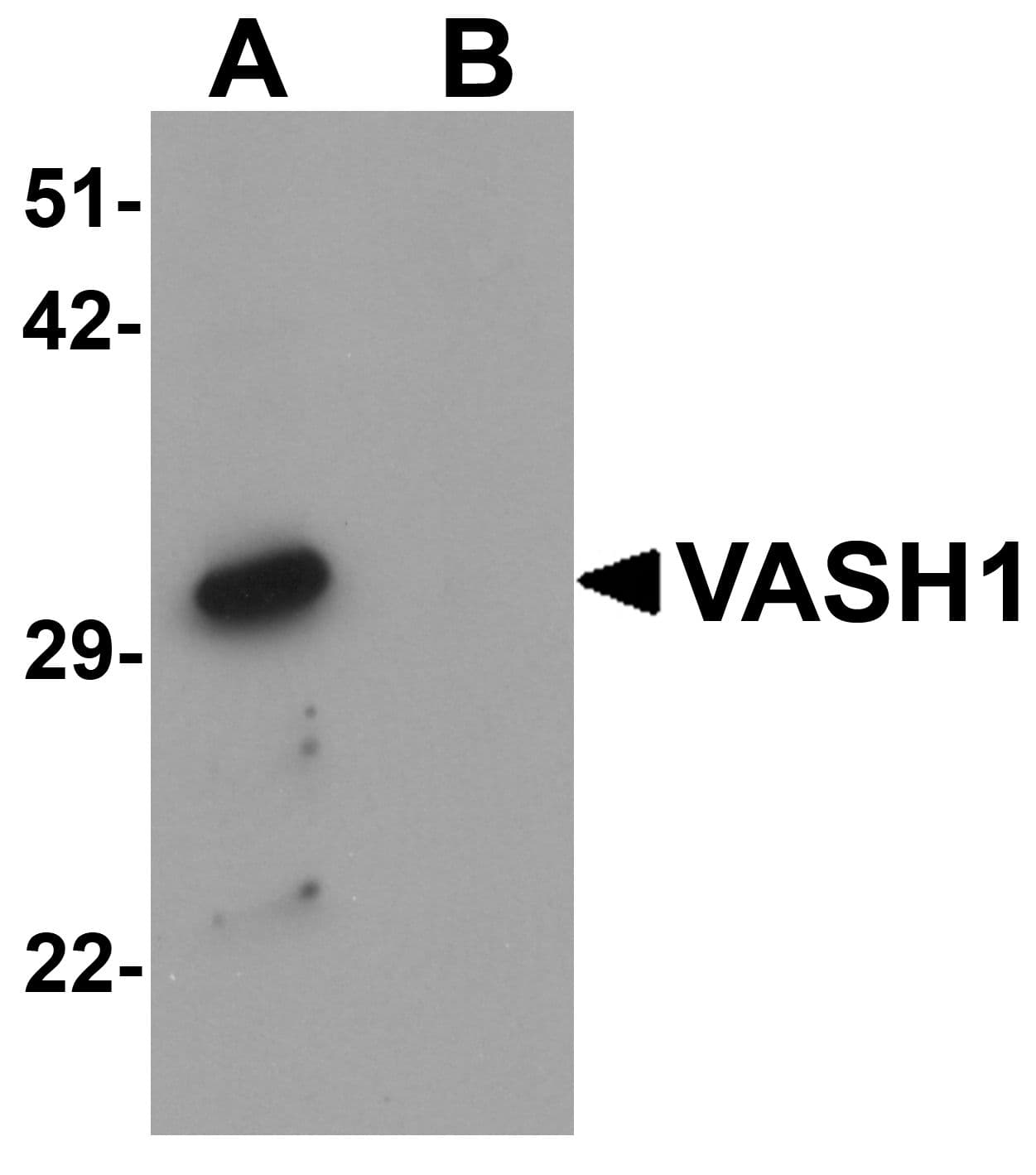 IHC-plus™ Vasohibin 1 / VASH1 Antibody
