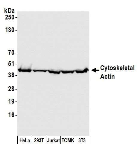 IHC-plus™ ACTB / Beta Actin Antibody (N-Terminus)