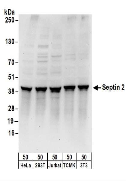 SEPT2 / Septin 2 Antibody (aa275-325)