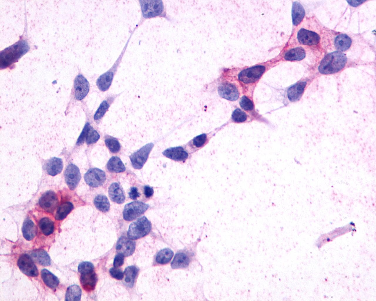 PathPlus™ GPR44 / CRTH2 Antibody (Extracellular Domain)