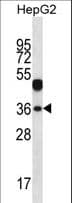 WDR45L Antibody (aa24-52)