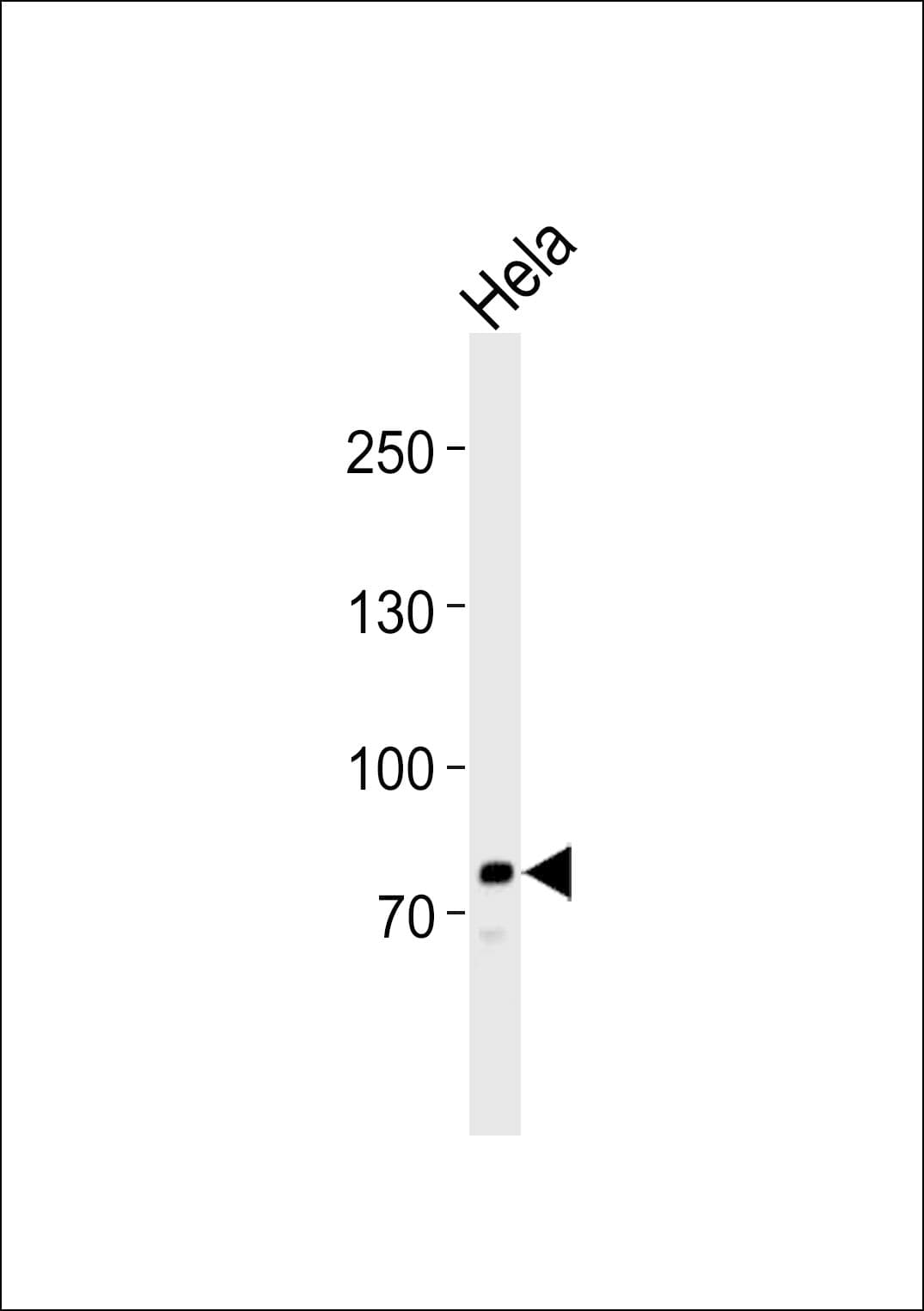 PCSK9 Antibody (aa479-508)