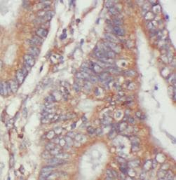 AMOT / Angiomotin Antibody