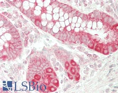 PathPlus™ Polyclonal Rabbit anti-Human BCL2L2 / Bcl-w Antibody (IHC, WB)