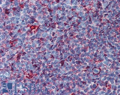 IHC-plus™ HLA-DP/DR Antibody (clone HL-40)