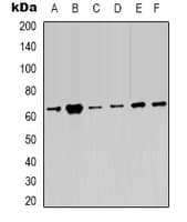 PRKAA2 / AMPK Alpha 2 Antibody