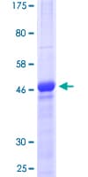Human CTGF Protein (Recombinant GST)