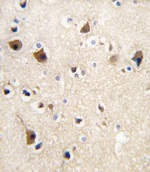 CALM1 / Calmodulin Antibody (aa117-149)