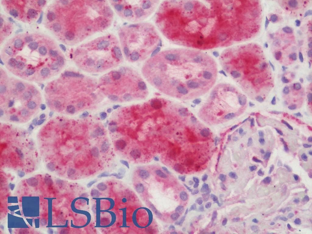 PathPlus™ VR1 / TRPV1 Antibody