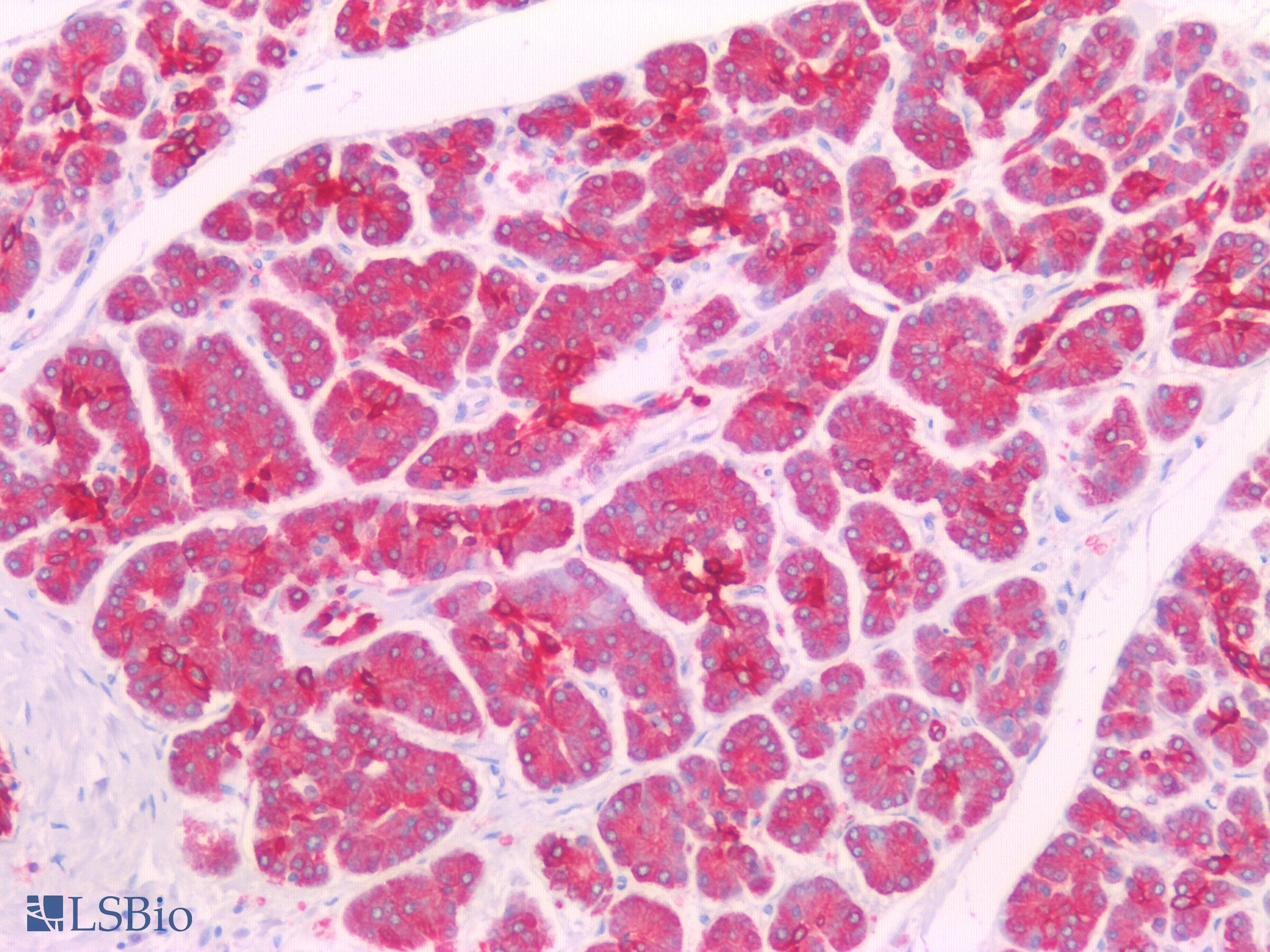 PathPlus™ Polyclonal Rabbit anti-Human KRT8 / CK8 / Cytokeratin 8 Antibody (C-Terminus, IHC, IF, WB)