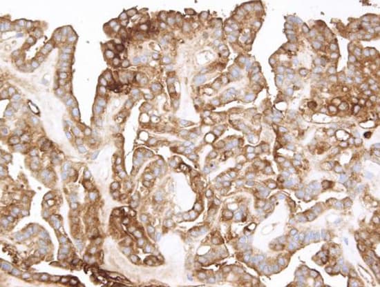 TG / Thyroglobulin Antibody (clone AHC0247, Ready-to-Use)