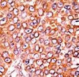 Polyclonal Rabbit anti-Human CDKN1B / p27 Kip1 Antibody (phospho-Thr157, IHC, WB)