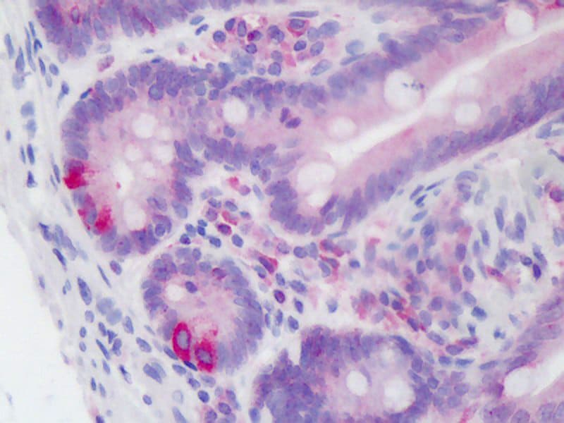 IHC-plus™ Polyclonal Rabbit anti-Human PDI / P4HB Antibody (IHC, IF, WB)