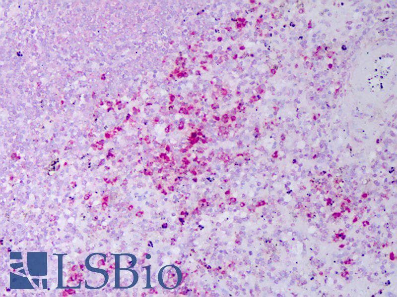 IHC-plus™ Monoclonal Mouse anti-Human RETN / Resistin Antibody (IHC, WB)