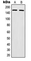 MSH6 Antibody (Internal)