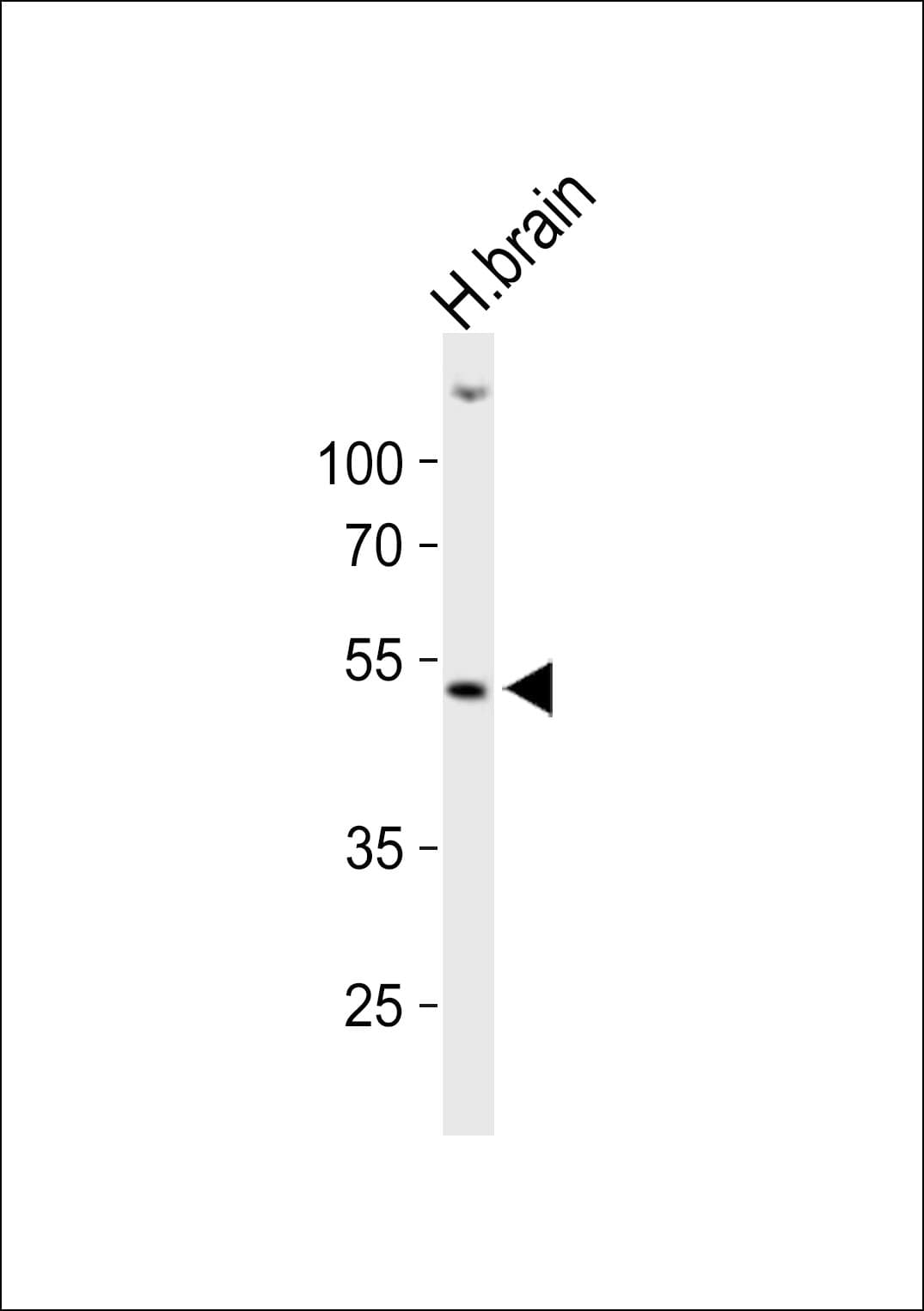 OX1R / Orexin Receptor 1 Antibody (aa256-291)