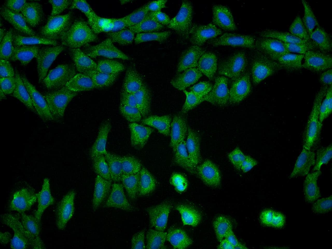 GCLM Antibody