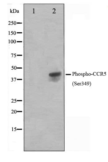 CCR5 Antibody (phospho-Ser349)