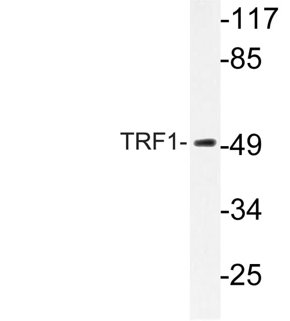 TRF1 / TERF1 Antibody (Leu215)
