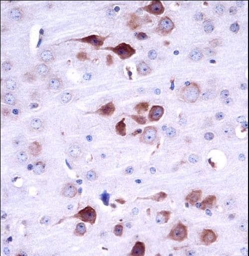 MATK Antibody (aa477-505)