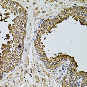 Polyclonal Rabbit anti-Human IF3mt / MTIF3 Antibody (IHC, WB)