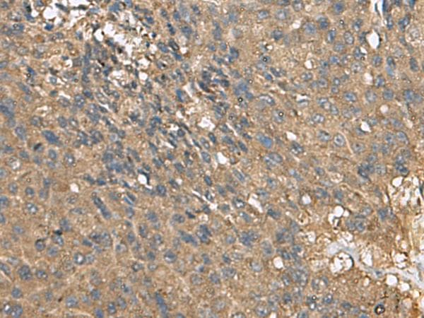 Polyclonal Rabbit anti-Human EIF1AX Antibody (IHC)