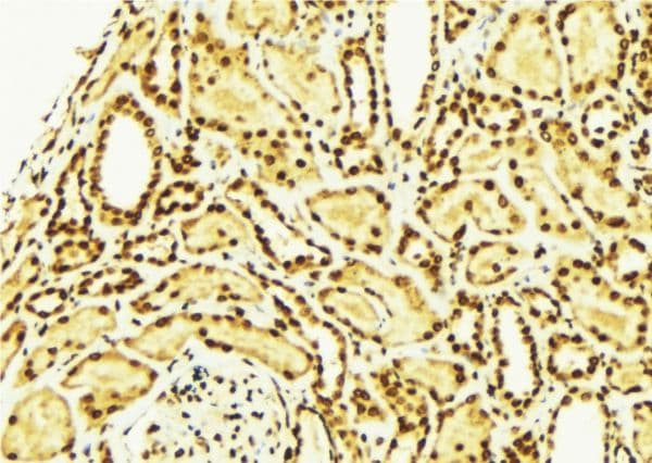 Polyclonal Rabbit anti-Human NRG1 / Heregulin / Neuregulin Antibody (IHC, WB)