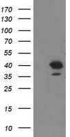 RTN4IP1 / NIMP Antibody (clone OTI1B2)