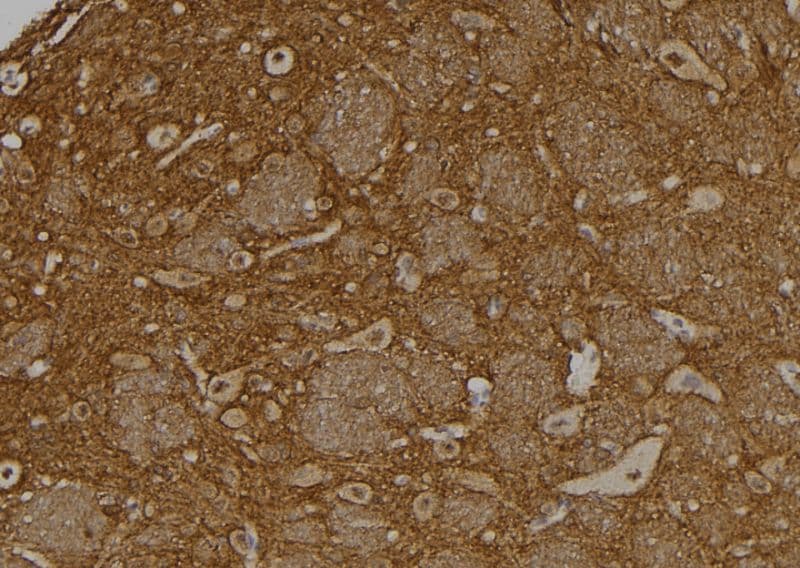 Polyclonal Rabbit anti-Human USP37 Antibody (IHC, WB)