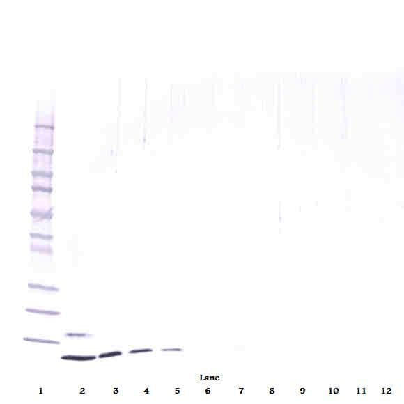 IHC-plus™ Monoclonal Mouse anti-Human RETN / Resistin Antibody (IHC, WB)