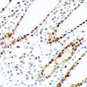 Polyclonal Rabbit anti-Human KHDRBS2 / SLM-1 Antibody (IHC, WB)