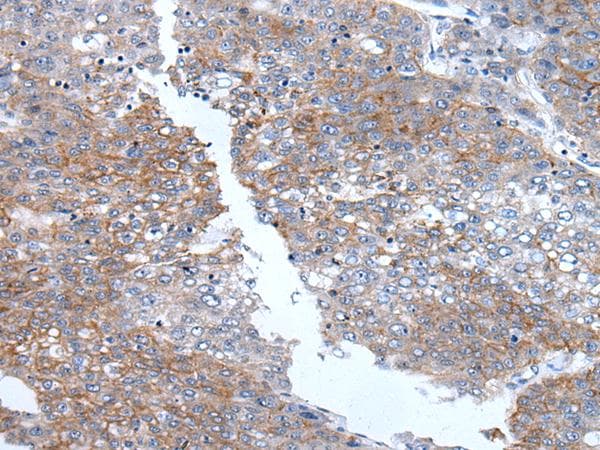 PRSS50 / TSP50 Antibody