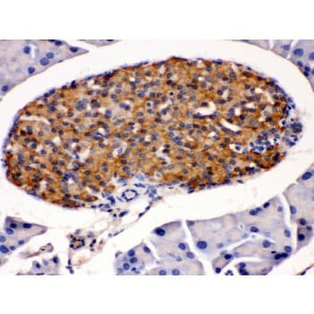 Polyclonal Rabbit anti-Human HSD2 / HSD11B2 Antibody (aa277-309, IHC, WB)