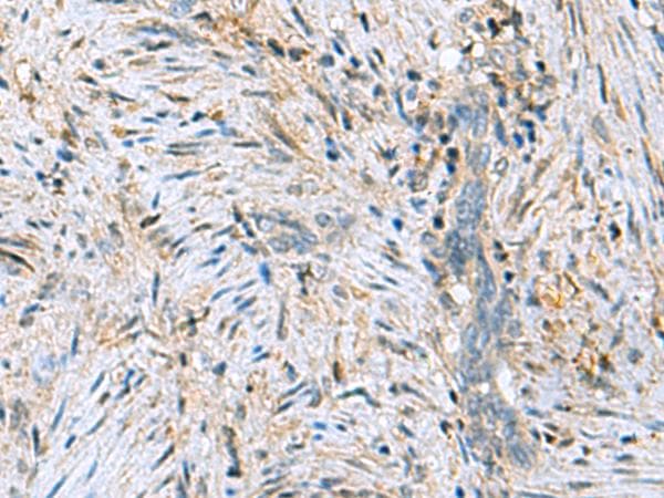 C6orf108 Antibody