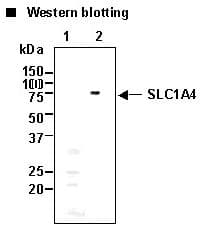 Polyclonal Rabbit anti-Human SLC1A4 / ASCT1 Antibody (IHC, WB)