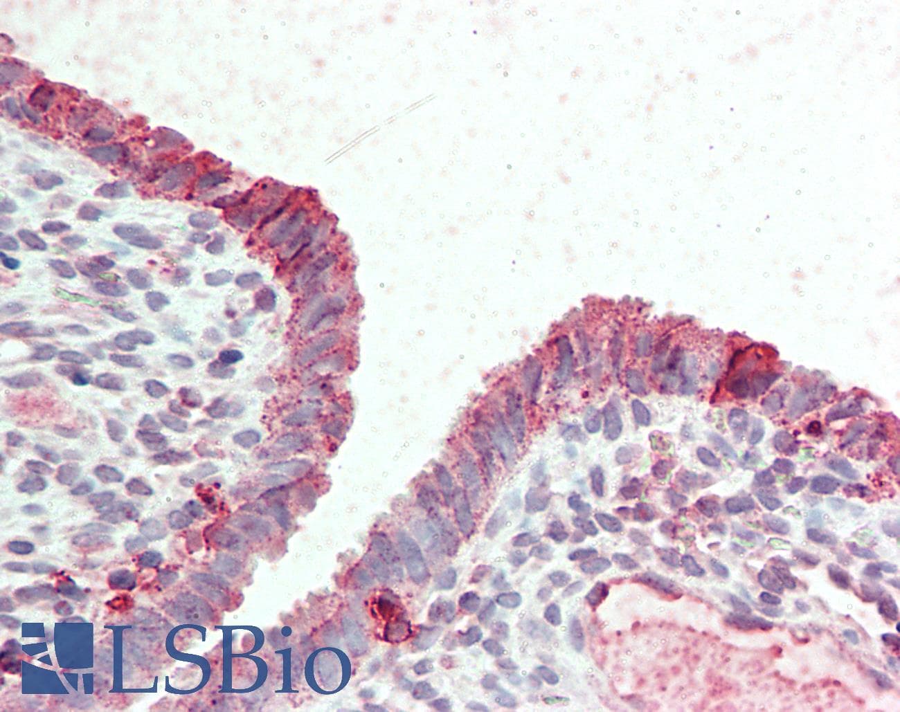 IHC-plus™ STEAP2 Antibody (Internal)