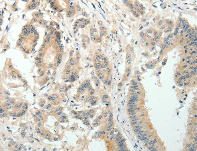 Polyclonal Rabbit anti-Human SIRT3 / Sirtuin 3 Antibody (IHC, WB)