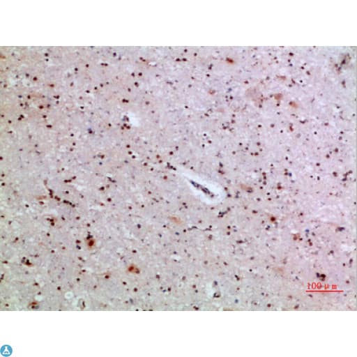 IL36A Antibody