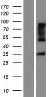 ZDHHC15 Protein (Over-Expression Lysate Myc-DDK (Flag))