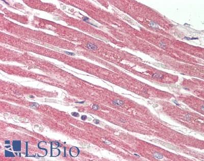 IHC-plus™ PVR / CD155 Antibody
