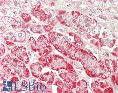 IHC-plus™ Polyclonal Rabbit anti-Human CNTFR Antibody (IHC, WB)