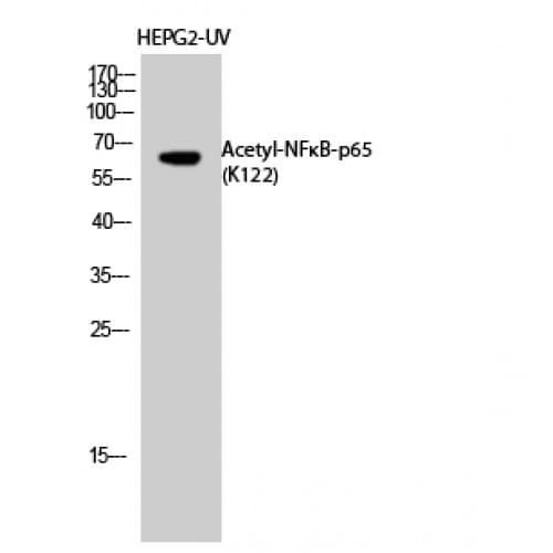 RELA / NFKB p65 Antibody (Acetyl-Lys122)