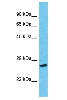 Polyclonal Rabbit anti-Human ORC6 / ORC6L Antibody (aa23-72, WB)