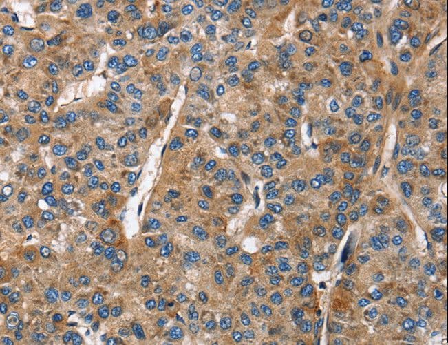 BGN / Biglycan Antibody