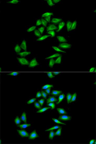 CPT1A Antibody
